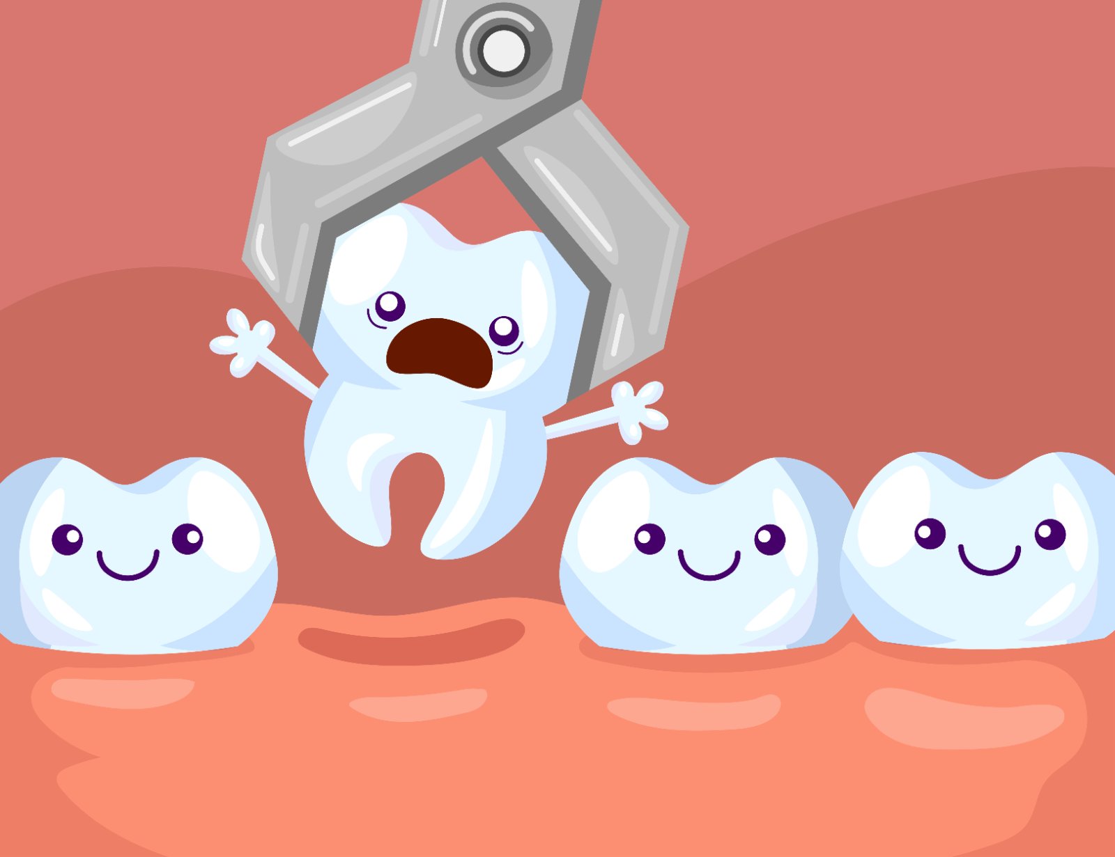 Dry Socket After a Tooth Extraction: Signs and What to Do