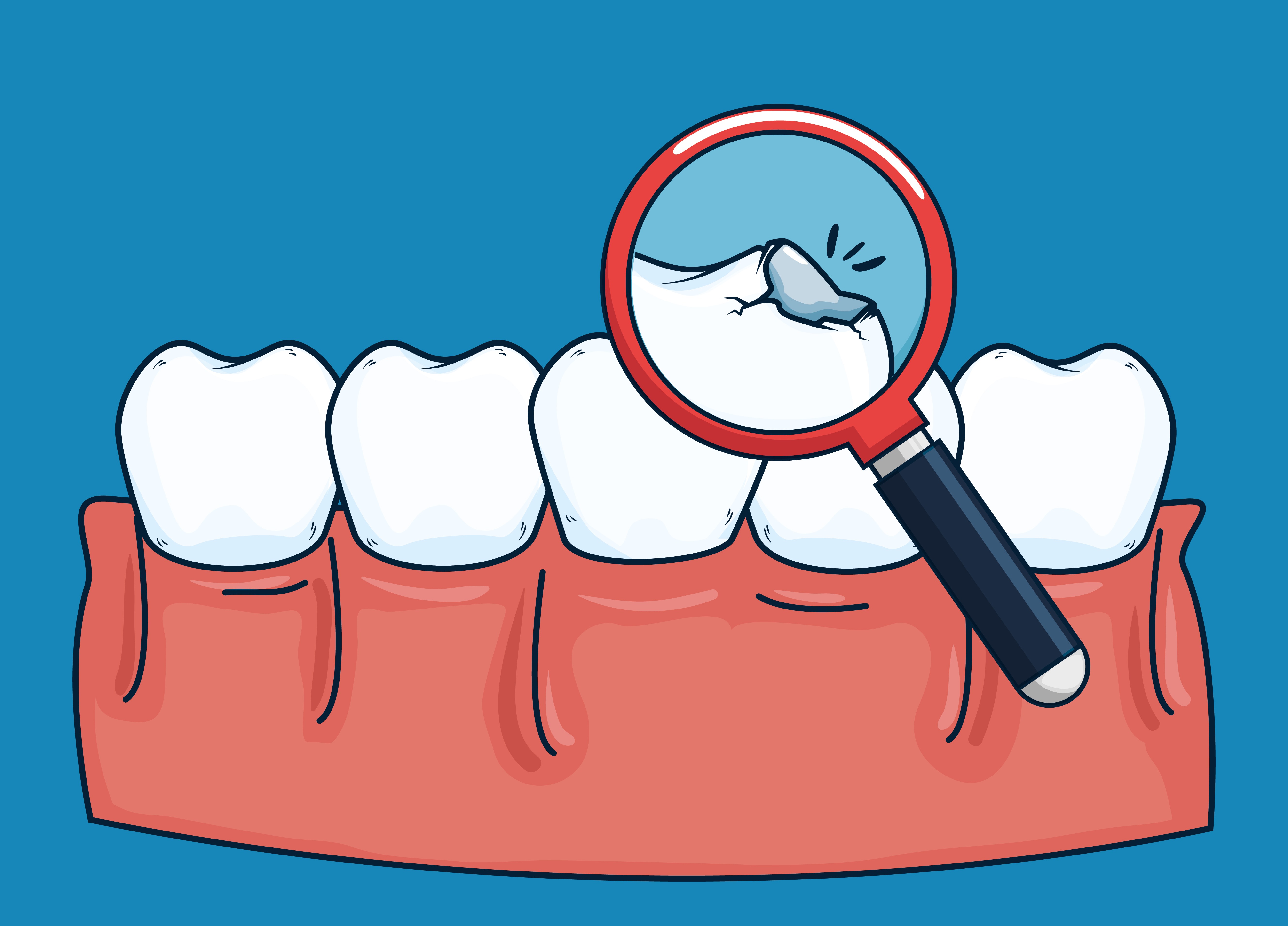 Chipped or Broken Front Tooth: What Are My Options?