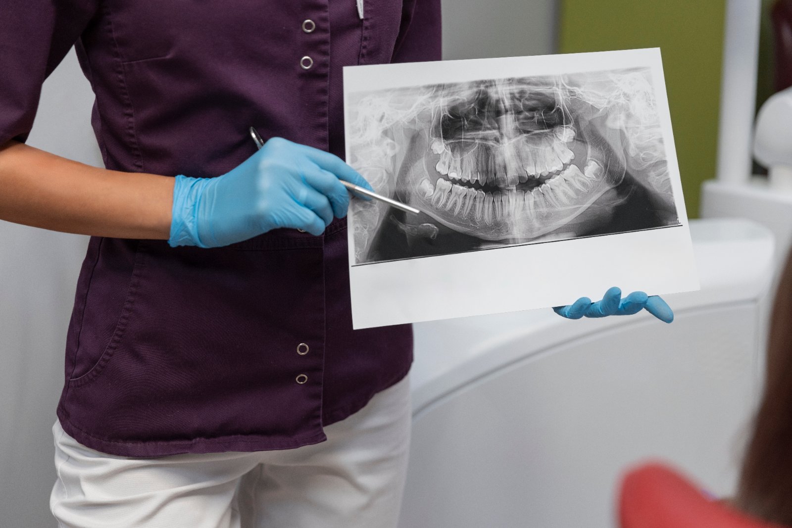 Are Dental X-Rays Safe, and How Often Do I Need Them?