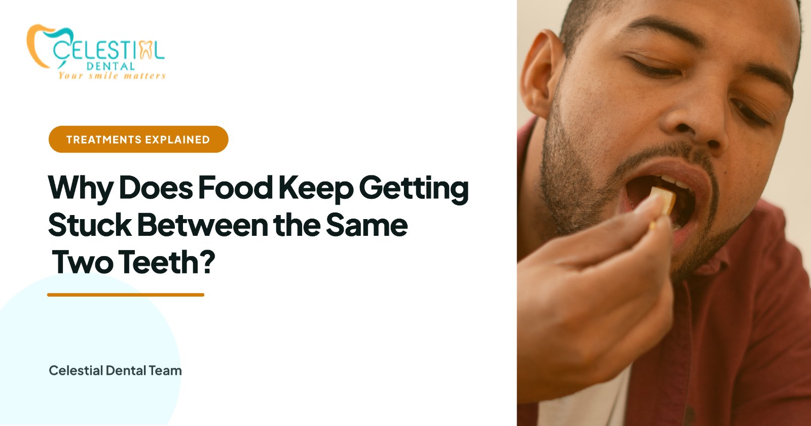 Why Does Food Keep Getting Stuck Between the Same Two Teeth?